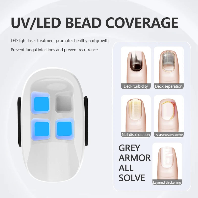 Justlang Portable Nail Fungus Laser