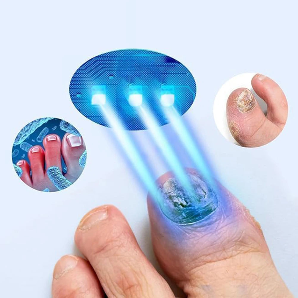 Portable Nail Fungal Cleaning Device