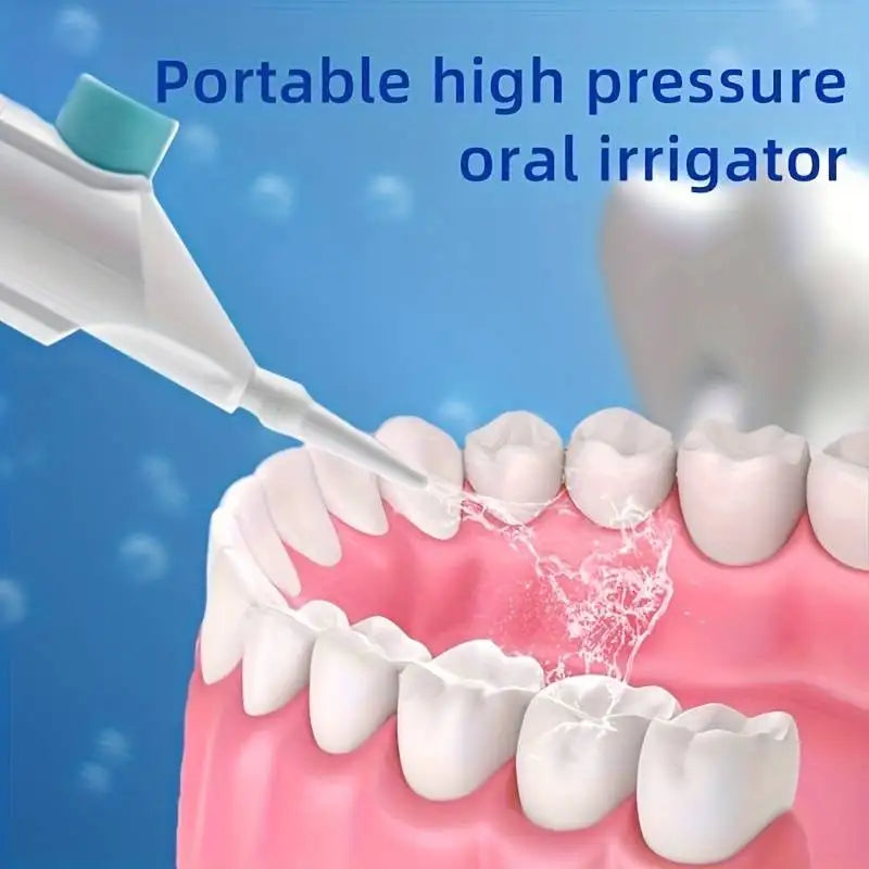 High-Pressure Oral Irrigator