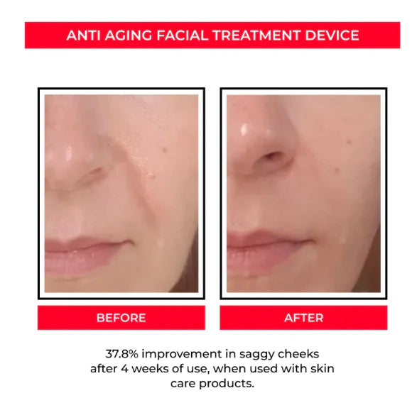 RevitaGlow EMS Pore & Skin Rejuvenation Tool.